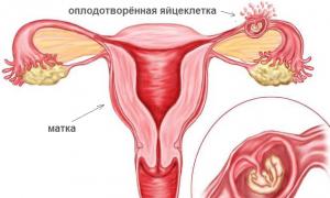 Менструальноподобное кровотечение в середине цикла