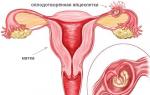 Менструальноподобное кровотечение в середине цикла