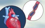 हृदय क्षेत्र में दर्द: कारण, उपचार के सिद्धांत हृदय में दर्द का कारण क्या है